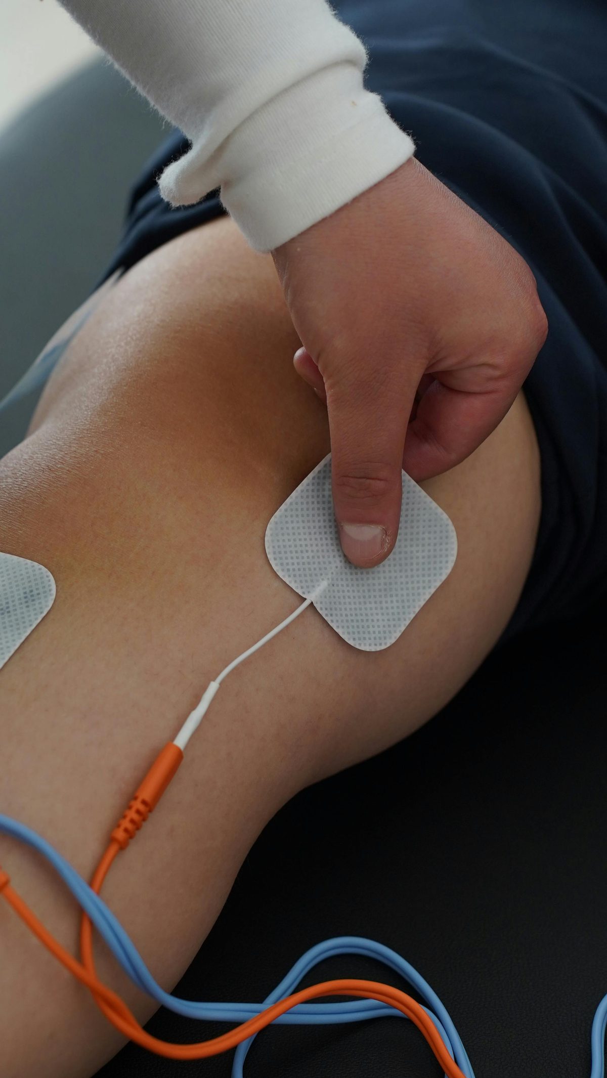 Dry needling treatment for muscle tension